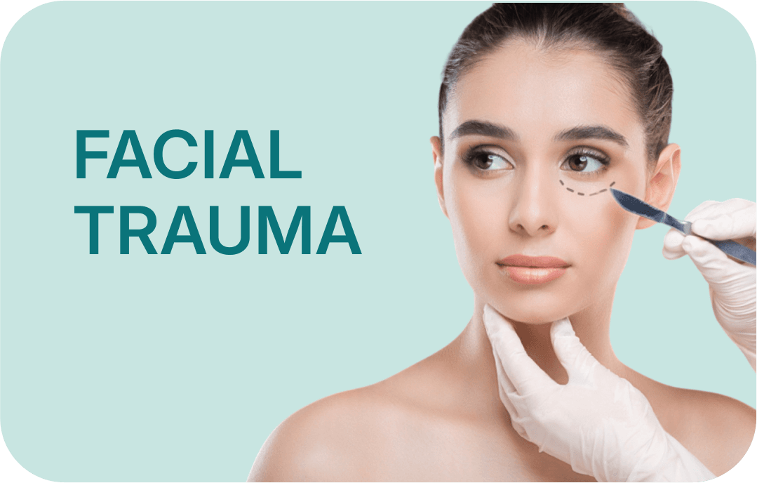 Facial Trauma